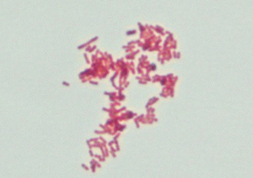 E. coli under the microscope.